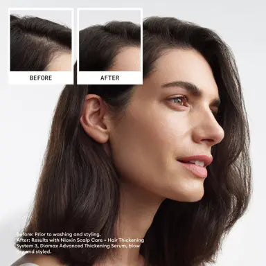 NIOXIN System 3 Kit