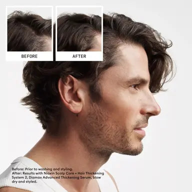 NIOXIN System 2 Kit